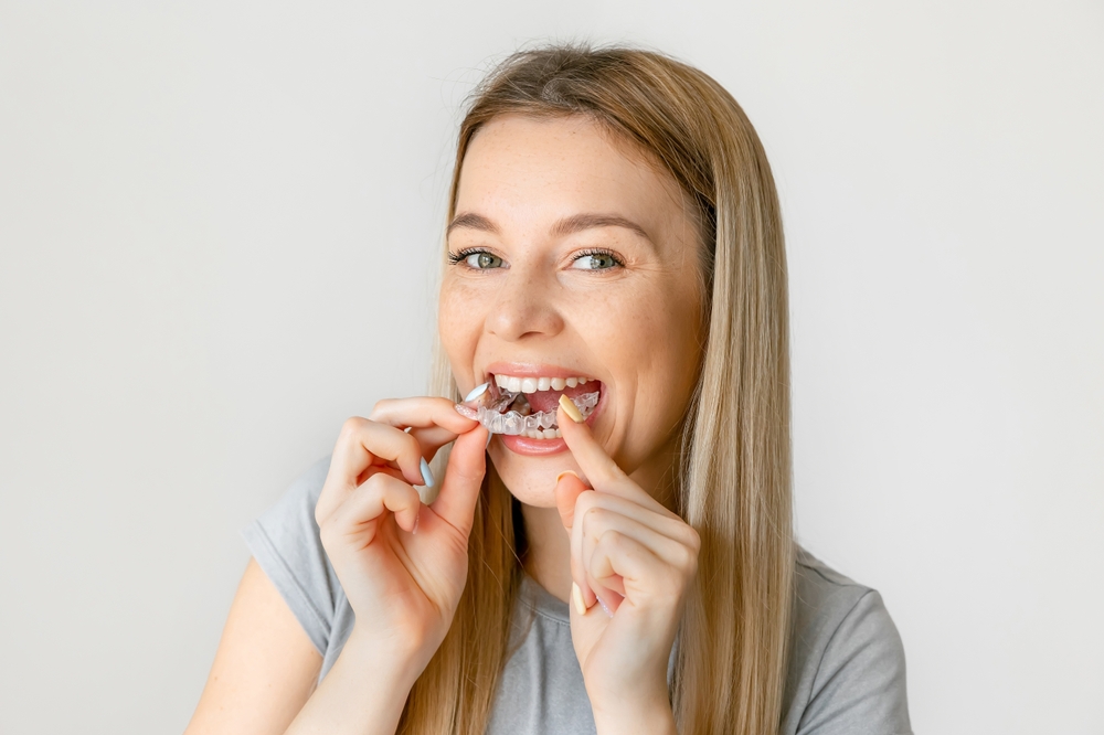 Clear Aligners Des Peres